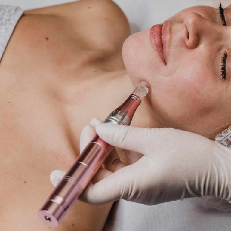 Dermapen